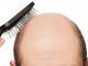 cure baldness