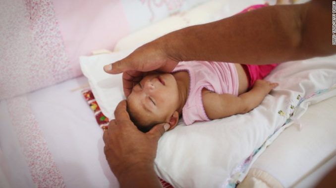 Authorities now say that the Zika virus causes autism