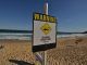 A pro surfer is in serious but stable condition after being mauled by a shark in Australia