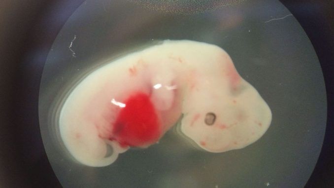 World's first pig human hybrid created in lab