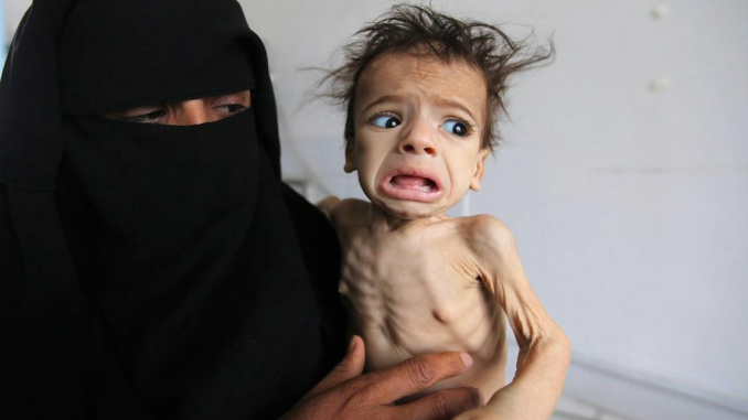 UN report warns of famine for 60% of people in Yemen