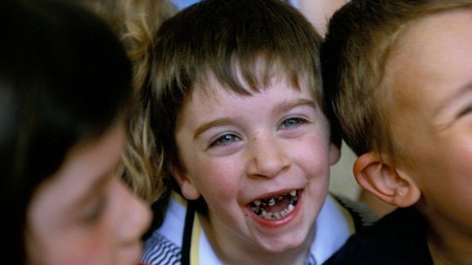 Ireland gripped by tooth decay crisis following the mass fluoridation of their water supply