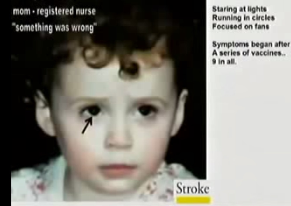 Impfstoff-Schaden-Gesicht-Zeichen