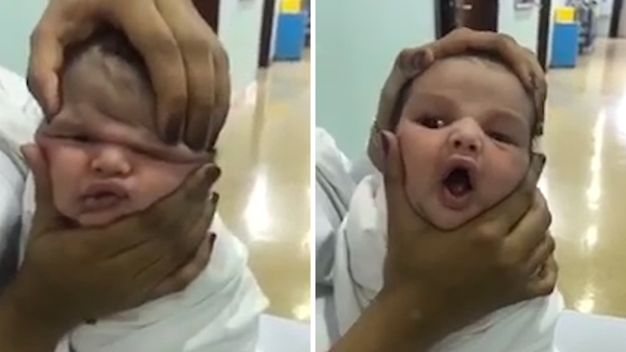 Nurses Fired After Footage Showing Them Squashing Babys -7643