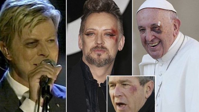 Celebrities and politicians with left black eyes are part of the Illuminati