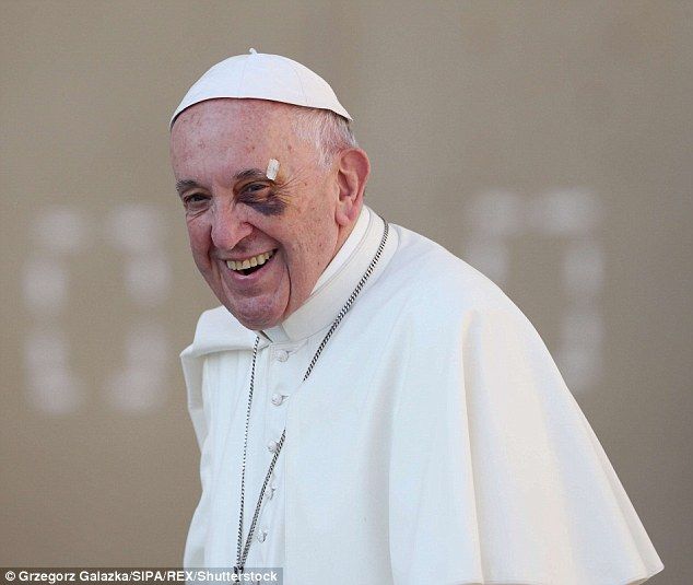 The Pope, pictured in 2017, has also been pictured with a black eye, which was said to have been caused by a collision while he was riding his 'pope-mobile' 