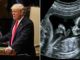 The Trump administration has canceled a contract signed by the FDA to purchase body parts from aborted babies for research purposes.