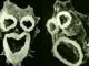 Brain-eating amoeba found in US tap water