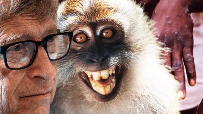 Bill Gates ran wargame that stimulated global monkeypox pandemic